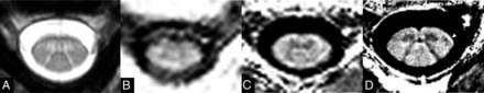 FIG 3.