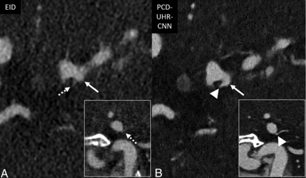 FIG 6.