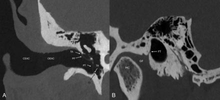 FIG 3.
