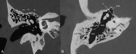 FIG 4.