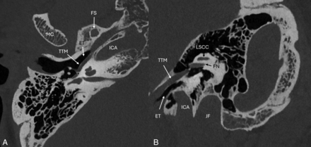 FIG 5.