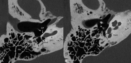 FIG 6.