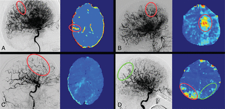 FIG 2.