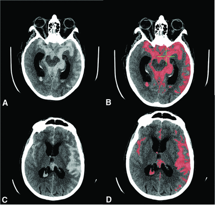 FIG 1.