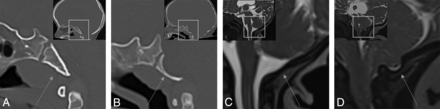 FIG 1.