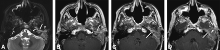 FIG 1.