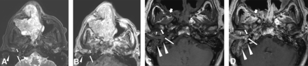 FIG 2.