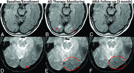 FIG 3.