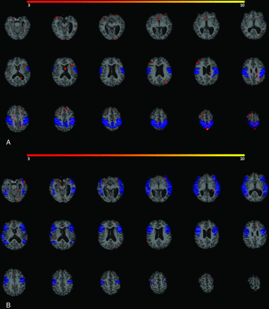 FIG 3.