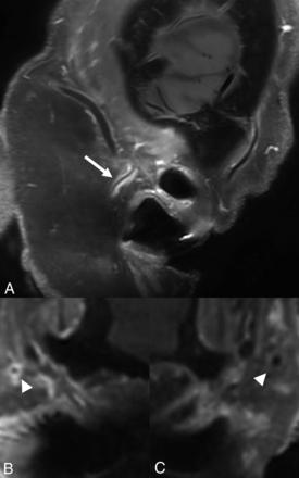 FIG 3.