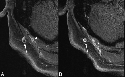 FIG 6.
