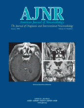 American Journal of Neuroradiology: 25 (1)