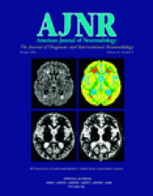 American Journal of Neuroradiology: 26 (9)