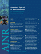 American Journal of Neuroradiology: 31 (2)