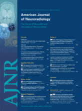 American Journal of Neuroradiology: 31 (3)