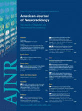 American Journal of Neuroradiology: 32 (9)