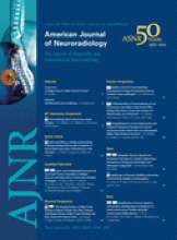 American Journal of Neuroradiology: 33 (1)