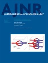 American Journal of Neuroradiology: 36 (5)