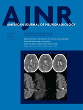 American Journal of Neuroradiology: 40 (10)