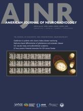 American Journal of Neuroradiology: 46 (2)