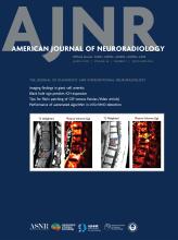 American Journal of Neuroradiology: 46 (3)